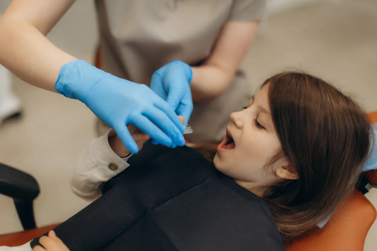 Fluoride Treatment
