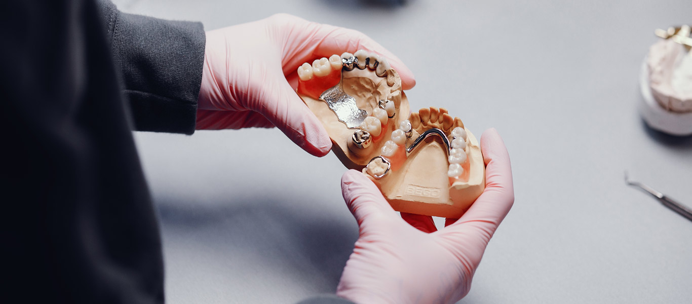 Dentist holding two dental molds while examining denture fitment